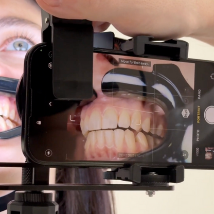 NEW! Dentiphoto Mobile Twin Light for Dental Photography