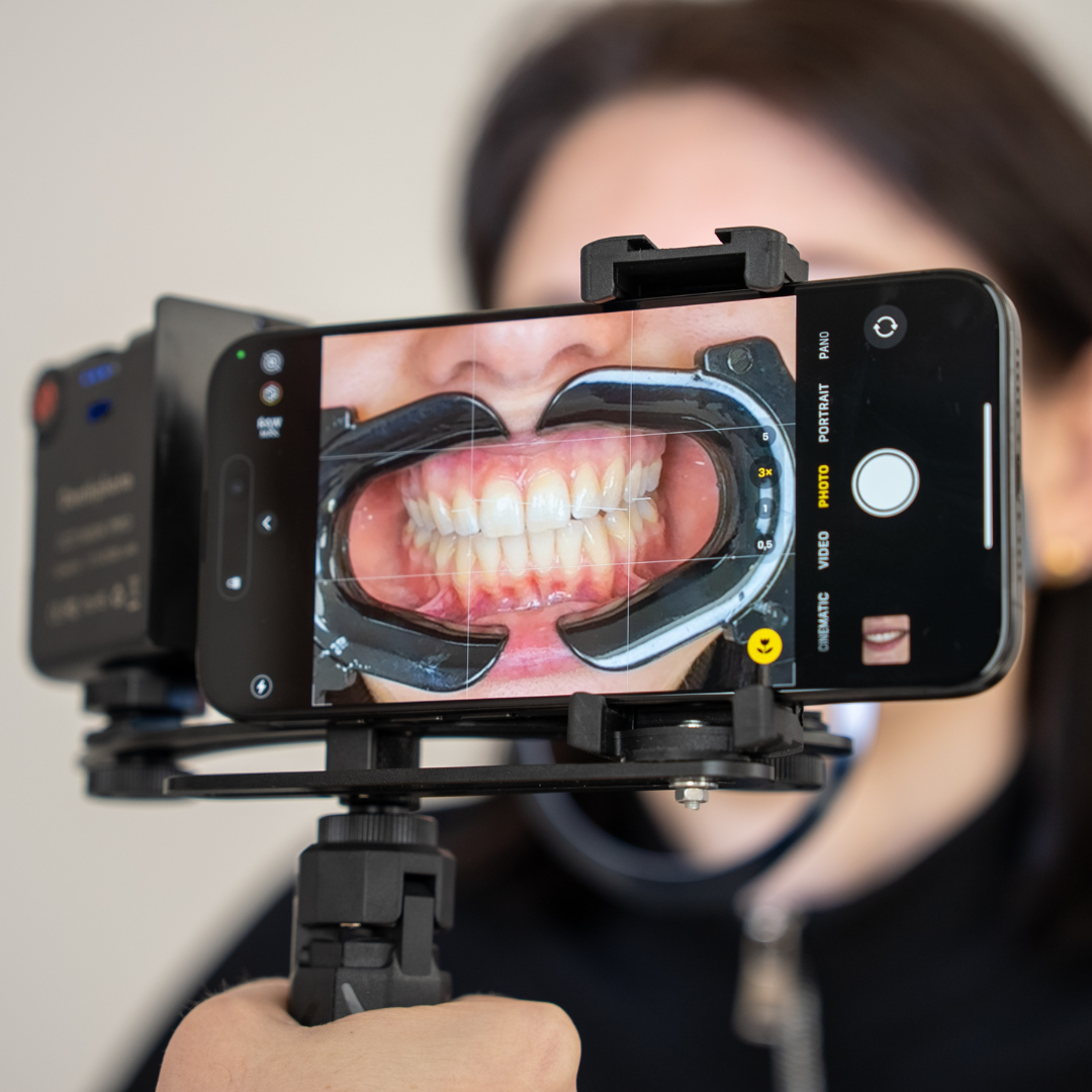 NEW! Dentiphoto Mobile Twin Light for Dental Photography