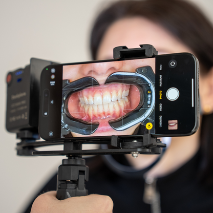 NEW! Dentiphoto Mobile Twin Light for Dental Photography